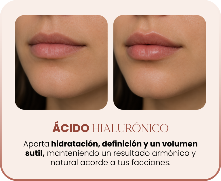 SERVICIOS_ACIDO H