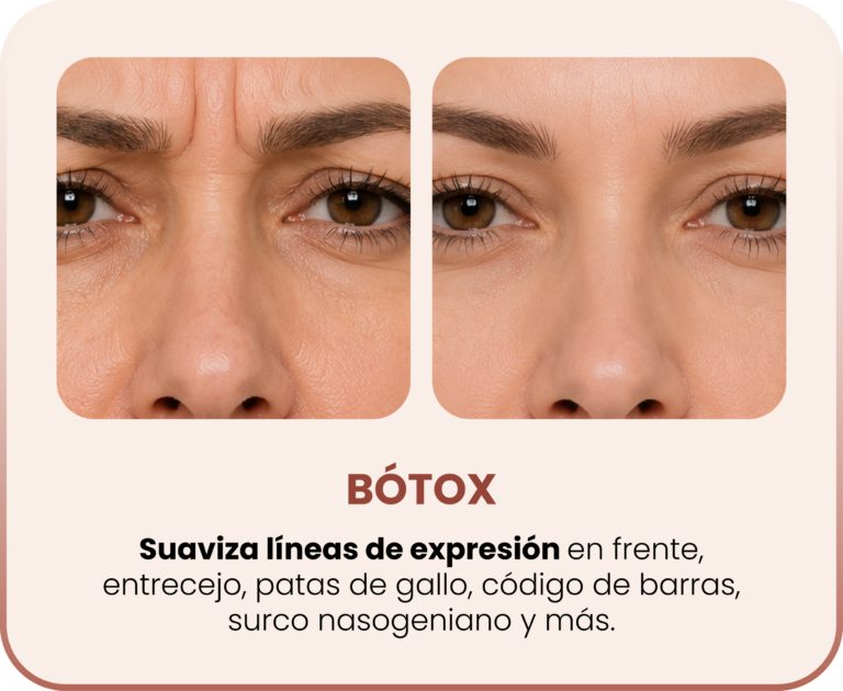 SERVICIOS_BOTOX