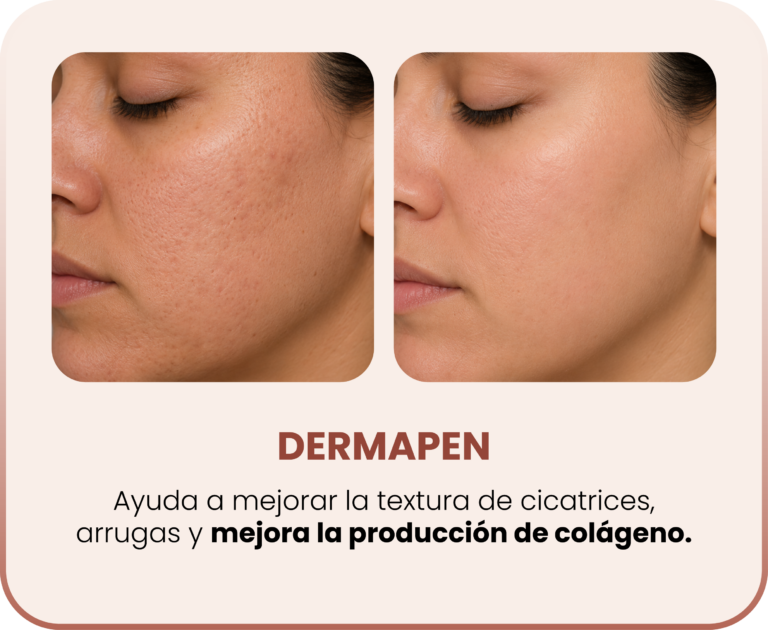 SERVICIOS_DERMAPEN